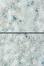 京大、老化細胞の除去に成功