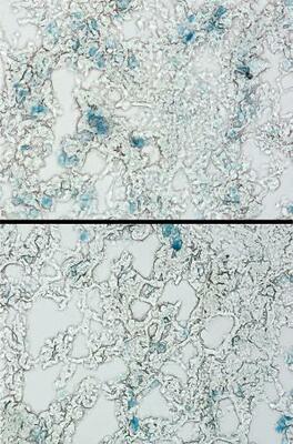 　未治療の肺線維症のマウスで老化細胞（青色）が存在する様子（上）と、ナトリン３ｂを投与し老化細胞（青色）が減少した様子（京都大近藤祥司准教授提供）