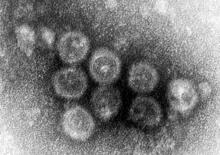 ＷＨＯ、日本の風疹「排除」認定