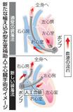 【からだ・こころナビ】東京女子医大、新術式で人工心臓植え込み