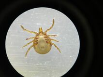 刺症被害、過去最多ペースに　タカサゴキララマダニ、栃木県内で18件