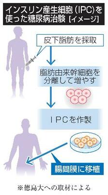 　インスリン産生細胞（ＩＰＣ）を使った糖尿病治験（イメージ）