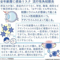 流行性角結膜炎　涙や目やに、結膜の充血　大人になり再びの感染も【白鷗大・岡田教授が解説】