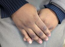 非正規滞在の子ども、将来見えず