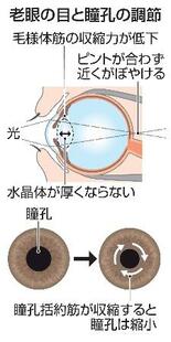 【からだ・こころナビ】老眼治療の点眼薬、米で承認