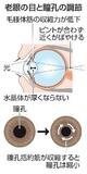 【からだ・こころナビ】老眼治療の点眼薬、米で承認