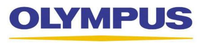 オリンパス、国内外2千人削減へ