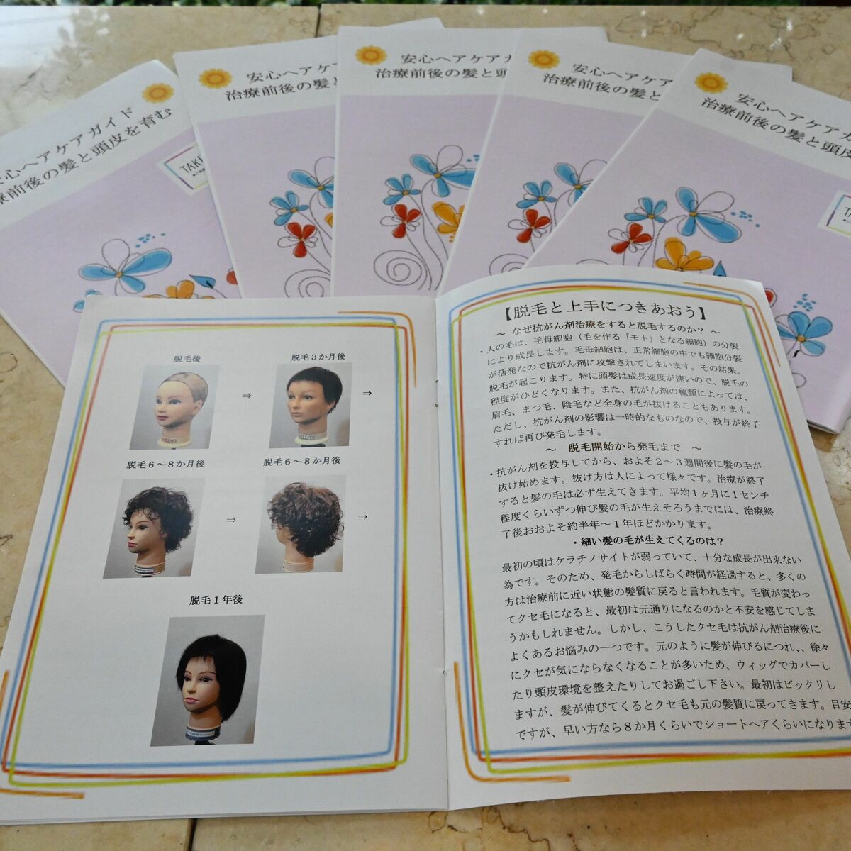 img_f41e327a8b09a3e200101a63c2