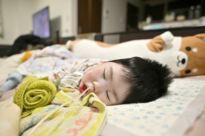 柚葵ちゃんはたんの吸引など日常的な介助が必要だ＝１月30日午後５時25分、磯真奈美撮影