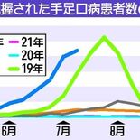 手足口病、10週連続で増加　栃木県内全域で警報レベル　過去最多2019…
