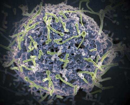 　細胞の表面に集まるエボラウイルス。緑色のひも状の粒子（米国立アレルギー感染症研究所提供）