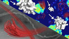 ＡＬＳ原因物質の抑制因子を発見