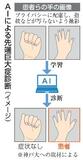 手の写真で難病をＡＩ診断